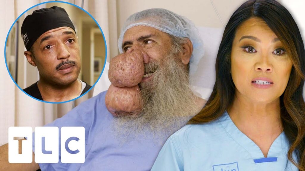 Dr. Lee & Specialists Finally Remove Roger’s Enormous Rynophyma! | Dr. Pimple Popper